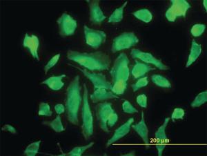 Anti-PRKCA Mouse Monoclonal Antibody [clone: 2F11]