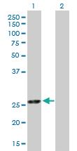 Anti-EXOSC5 Mouse Polyclonal Antibody