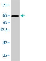 Anti-ACY1 Mouse Monoclonal Antibody [clone: 4F1-B7]