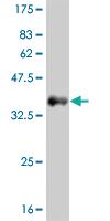 Anti-FGFR1 Mouse Monoclonal Antibody [clone: 3C9]