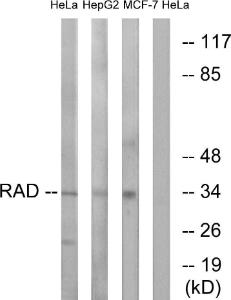 Western blot analysis of lysates from HeLa and HepG2/MCF-7 cells using Anti-RAD Antibody. The right hand lane represents a negative control, where the antibody is blocked by the immunising peptide.