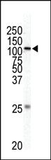 Anti-MAP3K1 Rabbit Polyclonal Antibody