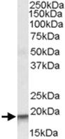 Anti-ARPC4 Goat Polyclonal Antibody