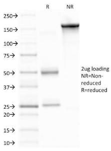 SDS-PAGE analysis of Anti-MMP9 Antibody [2C3] under non-reduced and reduced conditions; showing intact IgG and intact heavy and light chains, respectively. SDS-PAGE analysis confirms the integrity and purity of the antibody.