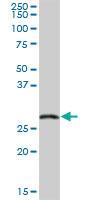 Anti-EXOSC5 Mouse Polyclonal Antibody