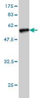 Anti-TREM1 Mouse Monoclonal Antibody [clone: 2E2]