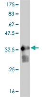 Anti-FGFR1 Mouse Monoclonal Antibody [clone: 2E12]