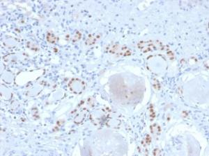 Immunohistochemical analysis of formalin-fixed, paraffin-embedded human kidney using Anti-PAX8 Antibody [PAX8/2774R]