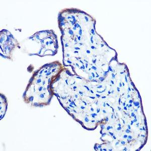 Immunohistochemistry analysis of paraffin-embedded human placenta using Anti-IKKi / IKKe Antibody [ARC0781] (A307678) at a dilution of 1:100 (40x lens). Perform microwave antigen retrieval with 10 mM PBS buffer pH 7.2 before commencing with IHC staining protocol.