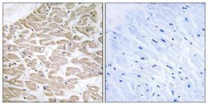 Immunohistochemical analysis of paraffin-embedded human heart tissue using Anti-RAD Antibody. The right hand panel represents a negative control, where the antibody was pre-incubated with the immunising peptide.