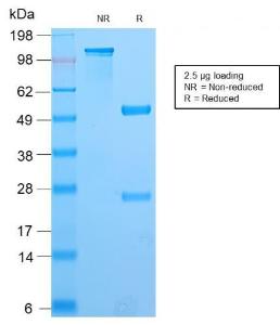 SDS-PAGE analysis of Anti-PAX8 Antibody [PAX8/2774R] under non-reduced and reduced conditions; showing intact IgG and intact heavy and light chains, respectively. SDS-PAGE analysis confirms the integrity and purity of the antibody