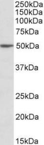 Anti-MON1A Antibody (A82601) (2µg/ml) staining of Jurkat lysate (35µg protein in RIPA buffer). Primary incubation was 1 hour. Detected by chemiluminescence.