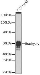 Western blot analysis of extracts of NCI-H460 cells, using Anti-Brachyury/Bry Antibody [ARC1983] (A305951) at 1:1000 dilution. The secondary Antibody was Goat Anti-Rabbit IgG H&L Antibody (HRP) at 1:10000 dilution. Lysates/proteins were present at 25 µg per lane