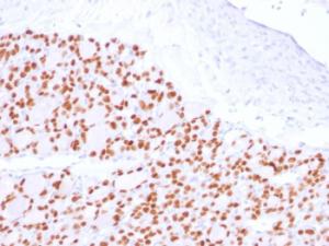 Immunohistochemical analysis of formalin-fixed, paraffin-embedded human thyroid using Anti-PAX8 Antibody [PAX8/2774R]