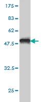 Anti-ZNF202 Mouse Monoclonal Antibody [clone: 1E9]