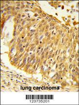 Anti-EEFSEC Rabbit Polyclonal Antibody (FITC (Fluorescein Isothiocyanate))