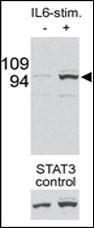 Anti-STAT3 Rabbit Polyclonal Antibody (FITC (Fluorescein))