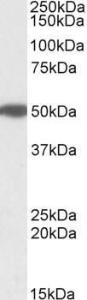 Anti-MON1A Antibody (A82602) (1 µg/ml) staining of Human Pancreas lysate (35 µg protein in RIPA buffer). Primary incubation was 1 hour. Detected by chemilu minescence