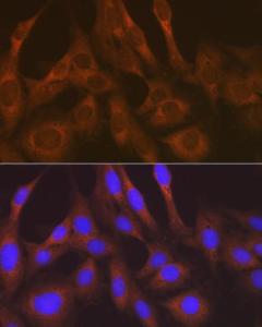 Anti-LysRS Rabbit Monoclonal Antibody [clone: ARC1765]