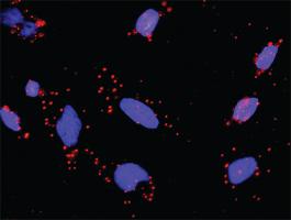 Anti-MAPK12 + DLG1 Antibody Pair