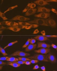 Anti-LysRS Rabbit Monoclonal Antibody [clone: ARC1765]