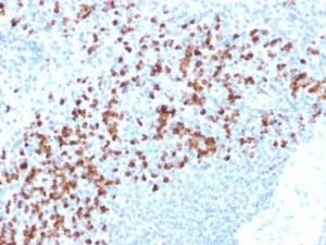 Anti-MMP9 antibody