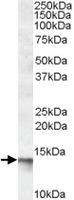 Anti-C1D Goat Polyclonal Antibody