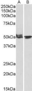 Anti-MON1A Antibody (A82602) (1 µg/ml) staining of Mouse (A) and Rat (B) Testis lysates (35 µg protein in RIPA buffer). Primary incubation was 1 hour. Detected by chemilu minescence