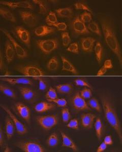 Anti-LysRS Rabbit Monoclonal Antibody [clone: ARC1765]