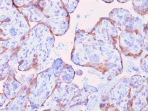 Anti-MMP3 Mouse Recombinant Antibody [clone: rMMP3/1730]