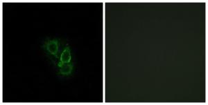 Immunofluorescence analysis of A549 cells using Anti-RAD Antibody. The right hand panel represents a negative control, where the antibody was pre-incubated with the immunising peptide.