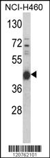 Anti-PRKACA Rabbit Polyclonal Antibody