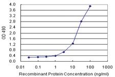 Anti-PPP2R3B Polyclonal Antibody Pair