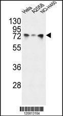 Anti-HSPA5 Rabbit Polyclonal Antibody (AP (Alkaline Phosphatase))