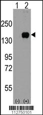 Anti-MAP3K5 Rabbit Polyclonal Antibody