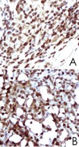 Anti-CD79A Rabbit Polyclonal Antibody