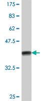 Anti-SUGT1 Mouse Polyclonal Antibody