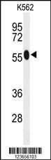 Anti-ACSM1 Rabbit Polyclonal Antibody (FITC (Fluorescein Isothiocyanate))