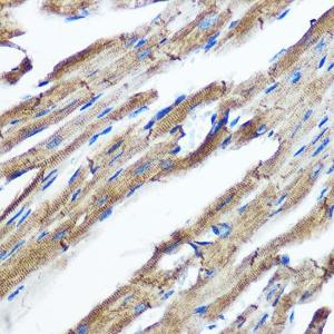 Immunohistochemistry analysis of paraffin-embedded mouse heart using Anti-IKKi / IKKe Antibody [ARC0781] (A307678) at a dilution of 1:100 (40x lens). Perform microwave antigen retrieval with 10 mM PBS buffer pH 7.2 before commencing with IHC staining protocol.