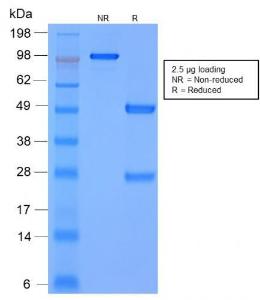 Anti-MMP3 Mouse Recombinant Antibody [clone: rMMP3/1730]