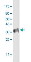 Anti-P2RX2 Mouse Monoclonal Antibody [clone: 3D5]