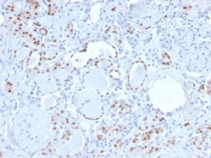 Immunohistochemical analysis of formalin-fixed, paraffin-embedded human kidney using Anti-PAX8 Antibody [PAX8/3688R]