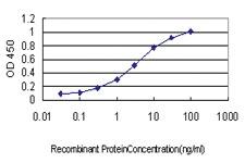 Anti-PRKCA Mouse Monoclonal Antibody [clone: 2F11]