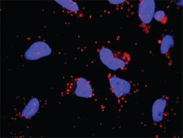 Anti-GP1BA + F12 Antibody Pair