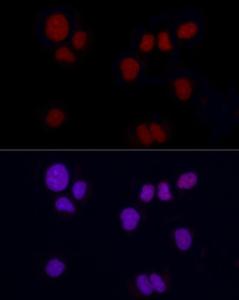 Immunofluorescence analysis of NCI-H460 using Anti-Brachyury/Bry Antibody [ARC1983] (A305951) at a dilution of 1:100 (40X lens). DAPI was used to stain the cell nuclei (blue)