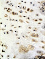 Anti-IGF1 Rabbit Polyclonal Antibody