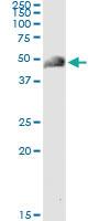 Anti-ACY1 Antibody Pair