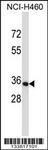 Anti-OR14C36 Rabbit Polyclonal Antibody (FITC (Fluorescein Isothiocyanate))