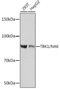 Western blot analysis of extracts of various cell lines, using Anti-NAK / TBK1 Antibody [ARC0778] (A307679) at 1:1,000 dilution. The secondary antibody was Goat Anti-Rabbit IgG H&L Antibody (HRP) at 1:10,000 dilution.