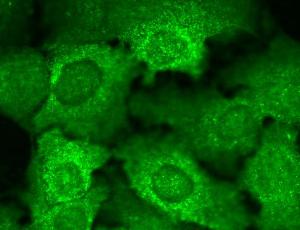 Immunocytochemistry/Immunofluorescence analysis of human HaCaT cells, fixed in cold 100% methanol for 10 minutes at -20°C, using Anti-CACNB2 Antibody [N8b/1] (A304748), at 1:100 for 1 hour at room temperatur